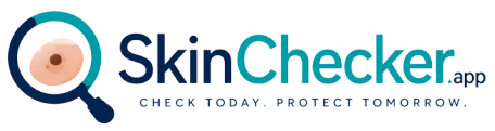 SKinChecker.app